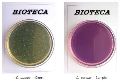 E. coli photographs